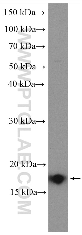 Western Blot (WB) analysis of A549 cells using SYNJ2BP Polyclonal antibody (15666-1-AP)