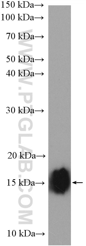Western Blot (WB) analysis of mouse kidney tissue using SYNJ2BP Polyclonal antibody (15666-1-AP)