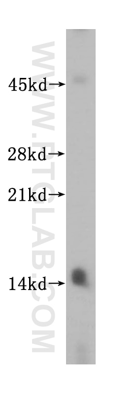 SYNJ2BP