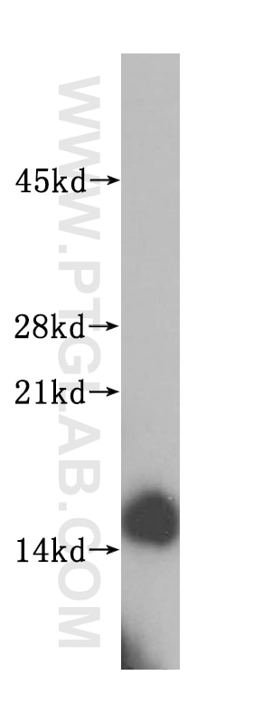 Western Blot (WB) analysis of human heart tissue using SYNJ2BP Polyclonal antibody (15666-1-AP)
