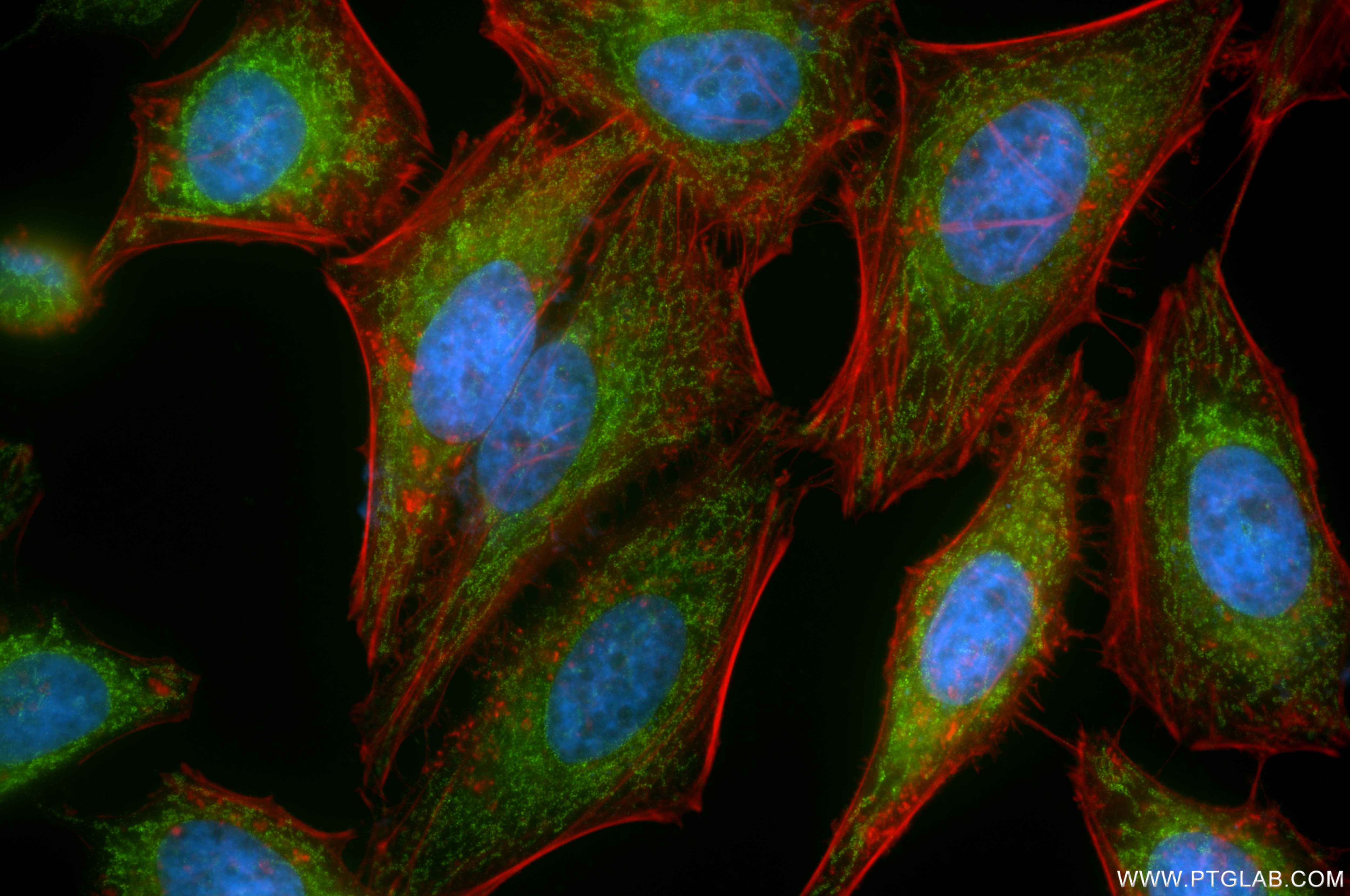 Immunofluorescence (IF) / fluorescent staining of HeLa cells using SYNJ2BP Recombinant antibody (85870-4-RR)