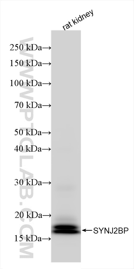 Western Blot (WB) analysis of rat kidney tissue using SYNJ2BP Recombinant antibody (85870-4-RR)