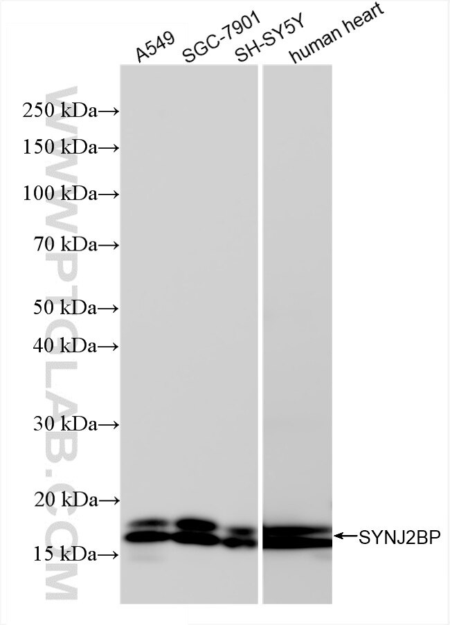 Western Blot (WB) analysis of various lysates using SYNJ2BP Recombinant antibody (85870-4-RR)