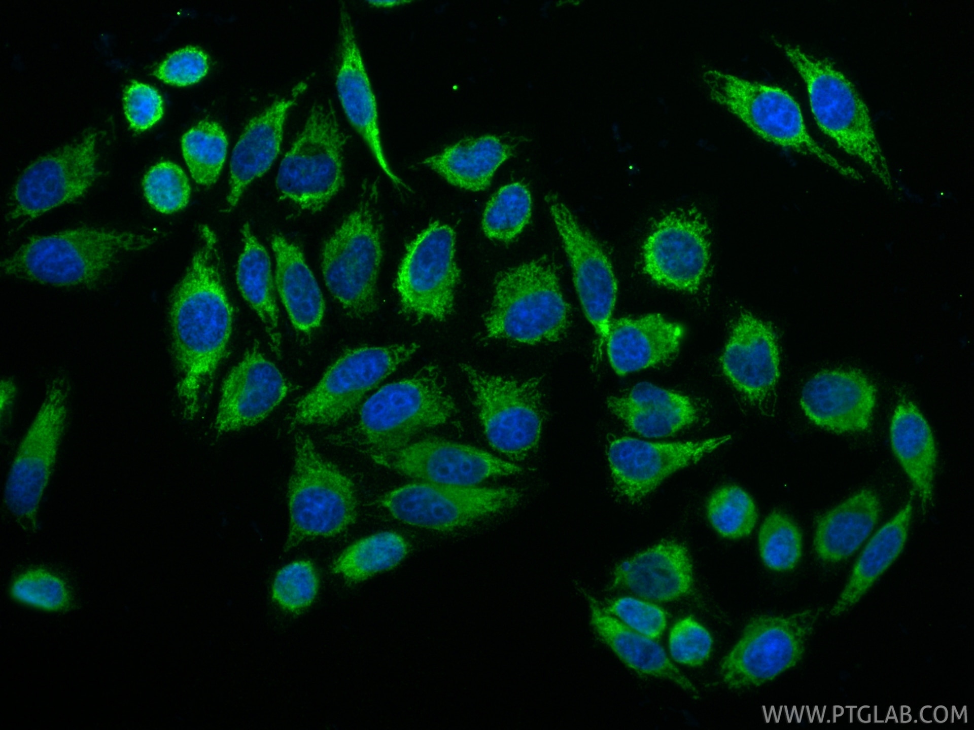 Immunofluorescence (IF) / fluorescent staining of HepG2 cells using Multi-rAb® SYNJ2BP Multi-Recombinant antibody (RMX00068)