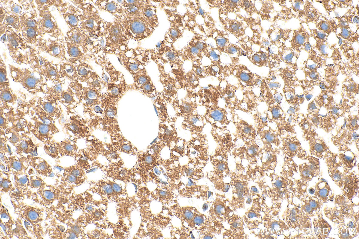 Immunohistochemistry (IHC) staining of mouse liver tissue using Multi-rAb® SYNJ2BP Multi-Recombinant antibody (RMX00068)