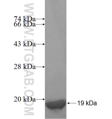 ARIP2; SYNJ2BP fusion protein Ag8231 SDS-PAGE