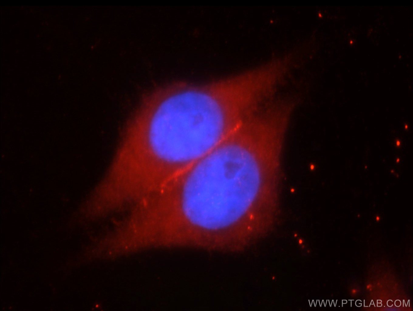 Immunofluorescence (IF) / fluorescent staining of HeLa cells using SYNM Polyclonal antibody (20735-1-AP)