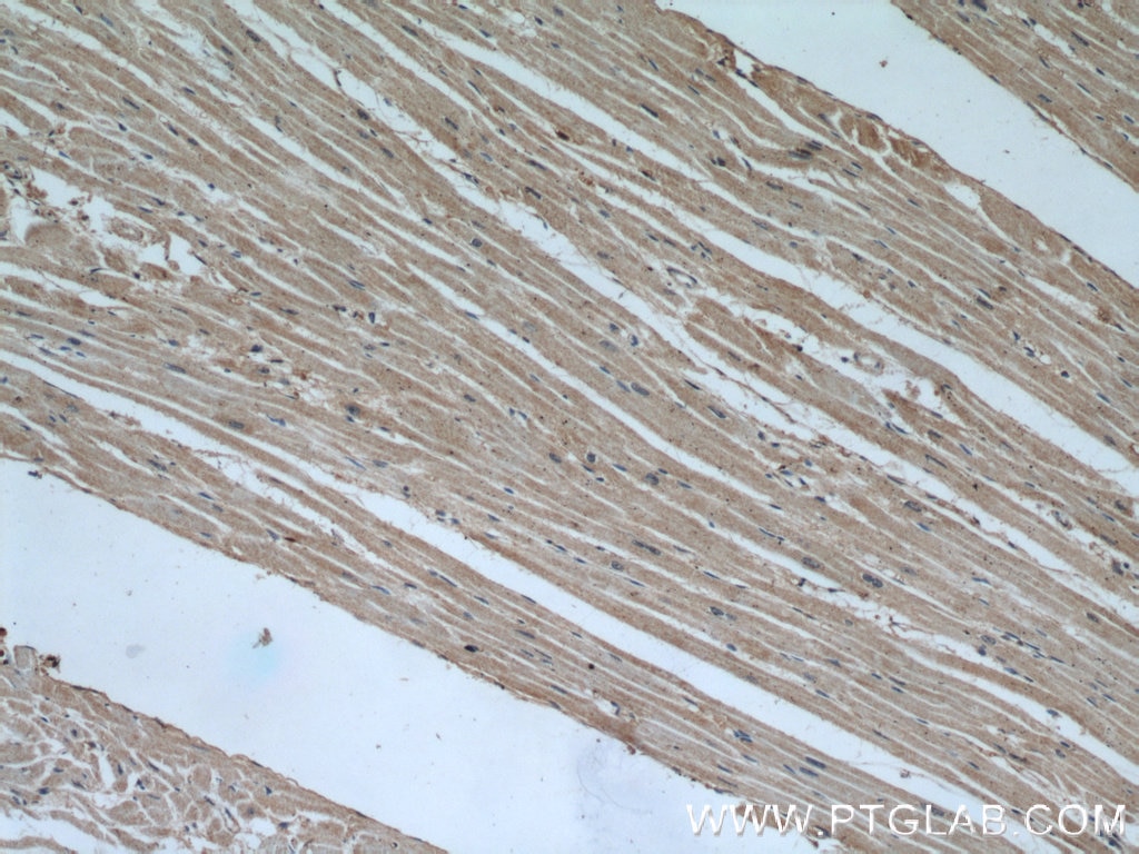 IHC staining of human heart using 20735-1-AP