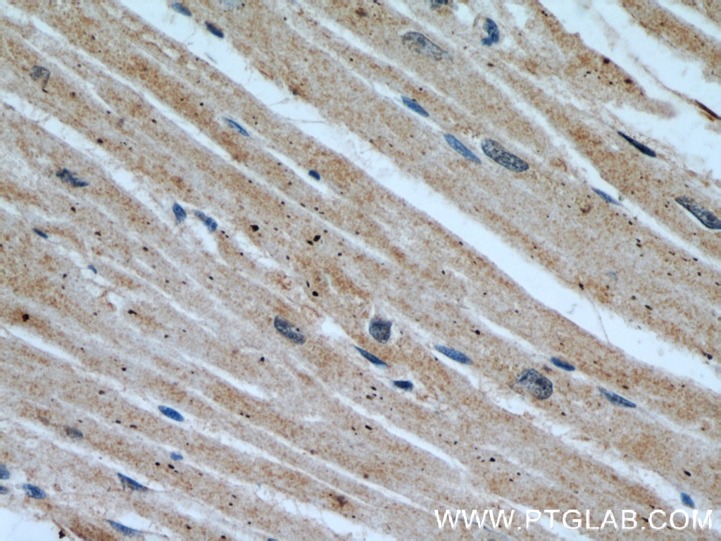 Immunohistochemistry (IHC) staining of human heart tissue using SYNM Polyclonal antibody (20735-1-AP)