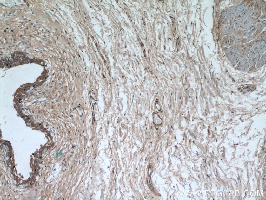 Immunohistochemistry (IHC) staining of human bladder tissue using SYNM Polyclonal antibody (20735-1-AP)