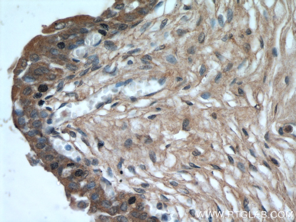 Immunohistochemistry (IHC) staining of human bladder tissue using SYNM Polyclonal antibody (20735-1-AP)