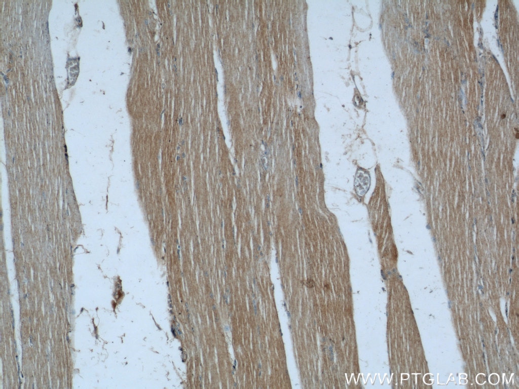 Immunohistochemistry (IHC) staining of human skeletal muscle tissue using SYNM Polyclonal antibody (20735-1-AP)