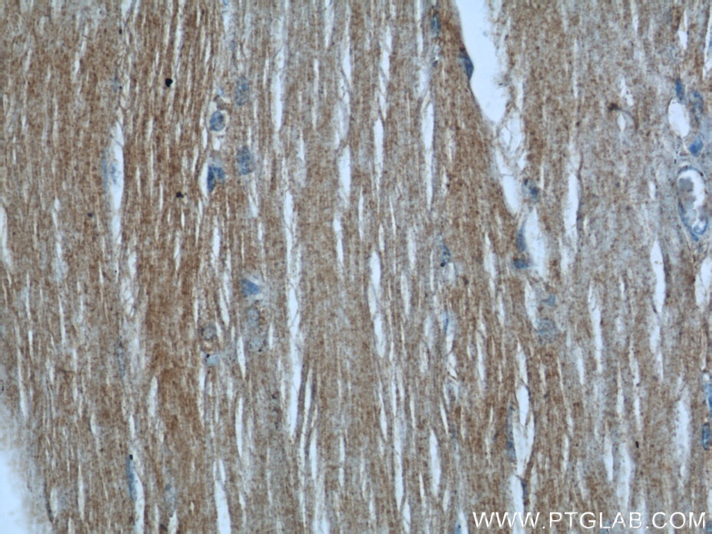 Immunohistochemistry (IHC) staining of human skeletal muscle tissue using SYNM Polyclonal antibody (20735-1-AP)