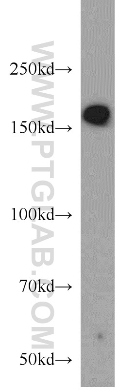 WB analysis of human skeletal muscle using 20735-1-AP