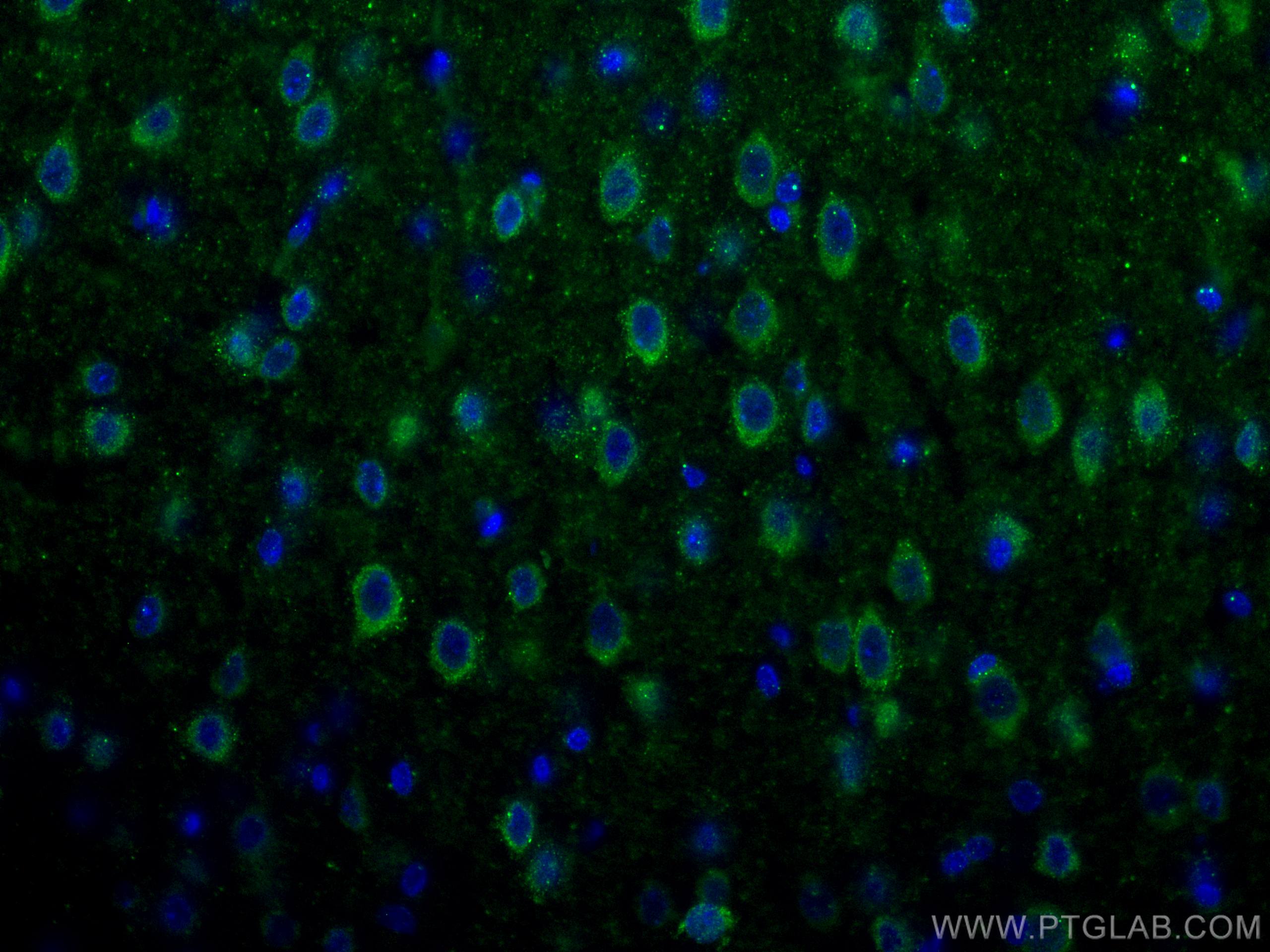 IF Staining of rat brain using 21064-1-AP