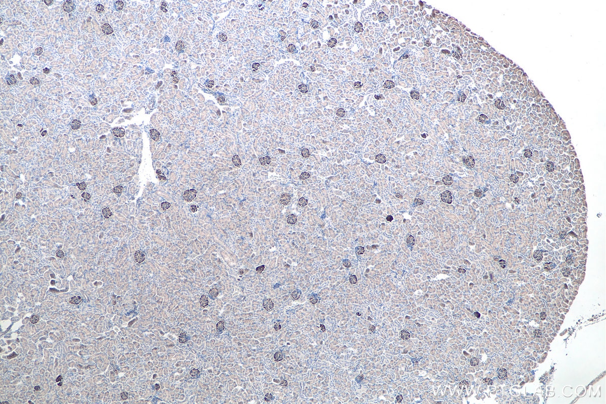 IHC staining of mouse kidney using 21064-1-AP