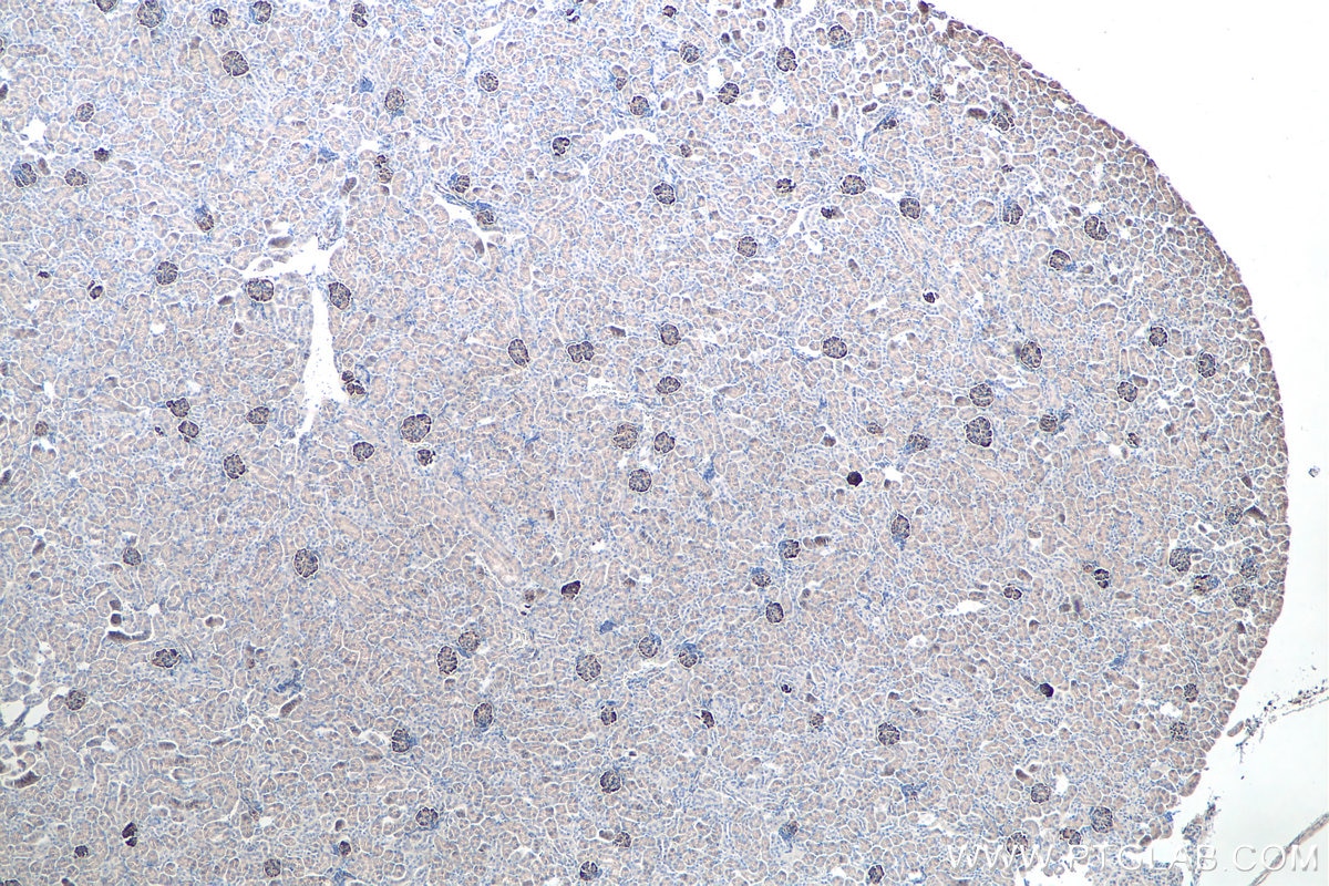 Immunohistochemistry (IHC) staining of mouse kidney tissue using SYNPO Polyclonal antibody (21064-1-AP)