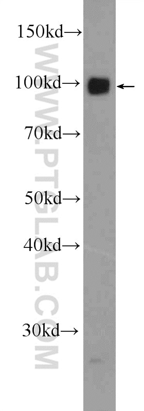 Western Blot (WB) analysis of rat brain tissue using SYNPO Polyclonal antibody (21064-1-AP)