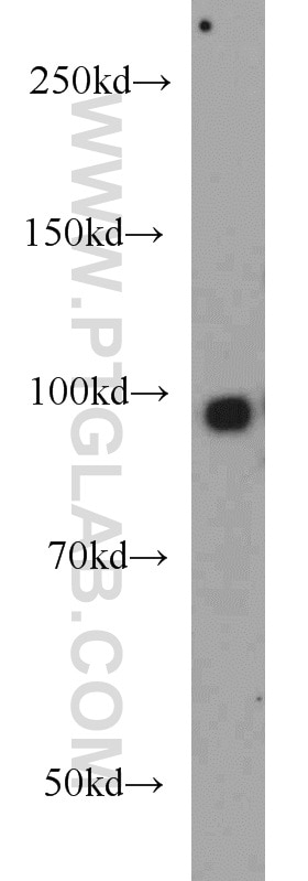 Western Blot (WB) analysis of mouse brain tissue using SYNPO Polyclonal antibody (21064-1-AP)