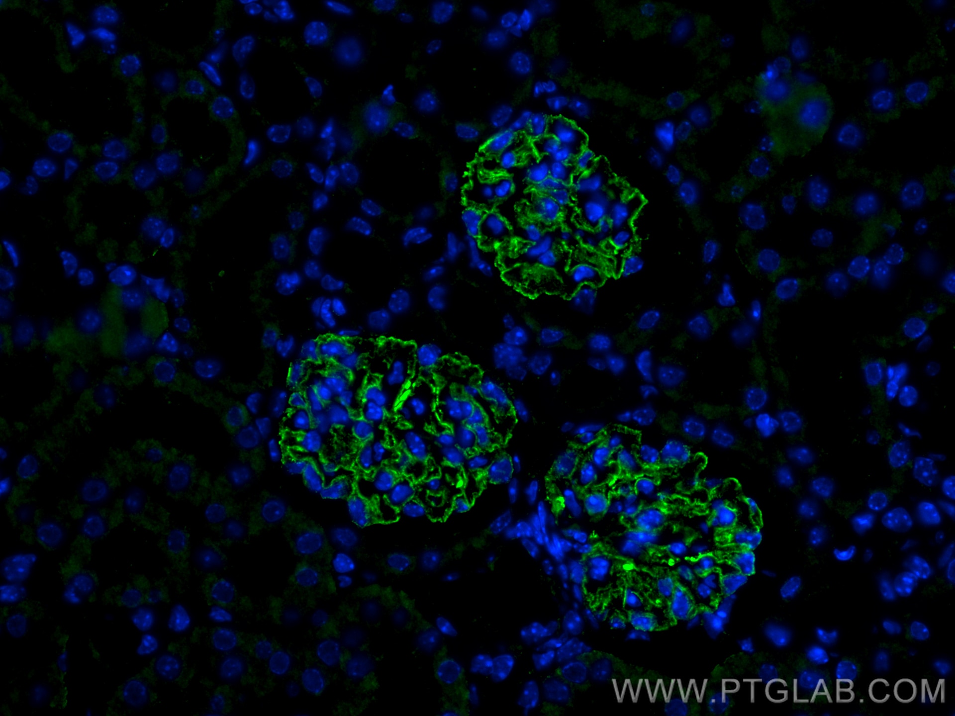 Immunofluorescence (IF) / fluorescent staining of mouse kidney tissue using SYNPO Monoclonal antibody (67339-1-Ig)