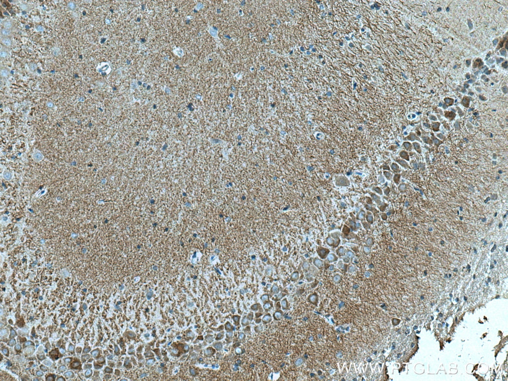 Immunohistochemistry (IHC) staining of rat brain tissue using SYNPO Monoclonal antibody (67339-1-Ig)