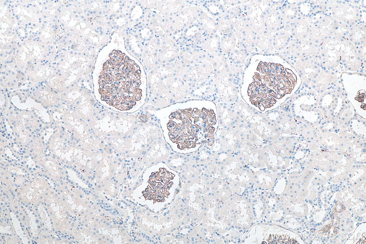 Immunohistochemistry (IHC) staining of human kidney tissue using SYNPO Monoclonal antibody (67339-1-Ig)