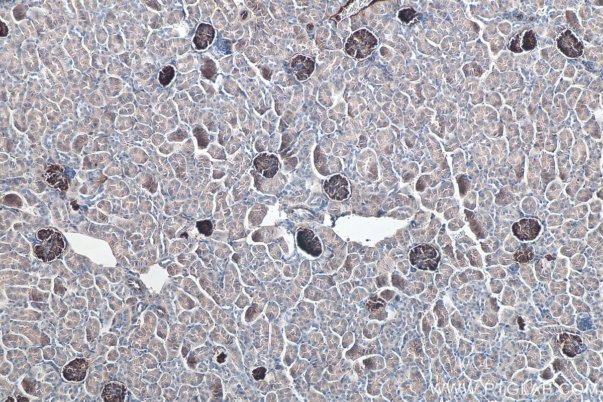 Immunohistochemistry (IHC) staining of mouse kidney tissue using SYNPO Monoclonal antibody (67339-1-Ig)