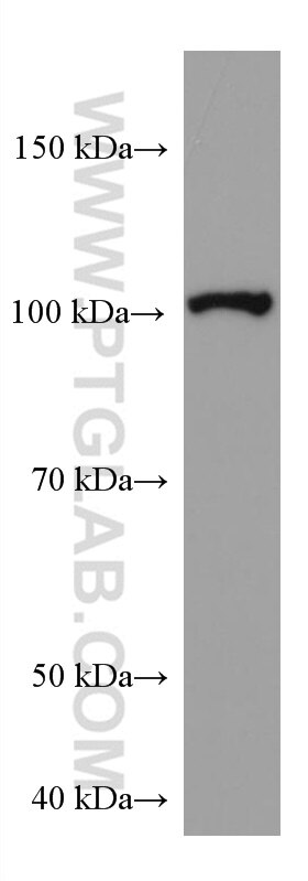 Western Blot (WB) analysis of pig brain tissue using SYNPO Monoclonal antibody (67339-1-Ig)