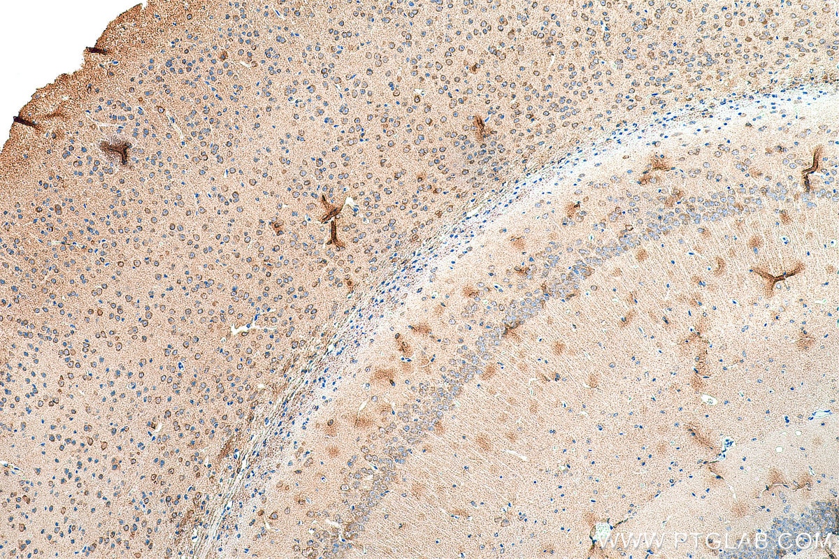 IHC staining of mouse brain using 80721-1-RR