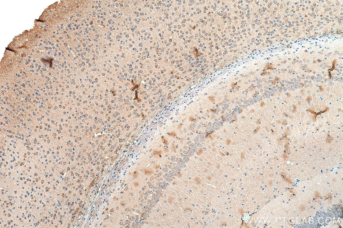 Immunohistochemistry (IHC) staining of mouse brain tissue using SYNPO Recombinant antibody (80721-1-RR)