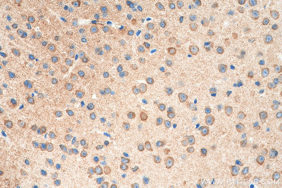 Immunohistochemistry (IHC) staining of mouse brain tissue using SYNPO Recombinant antibody (80721-1-RR)