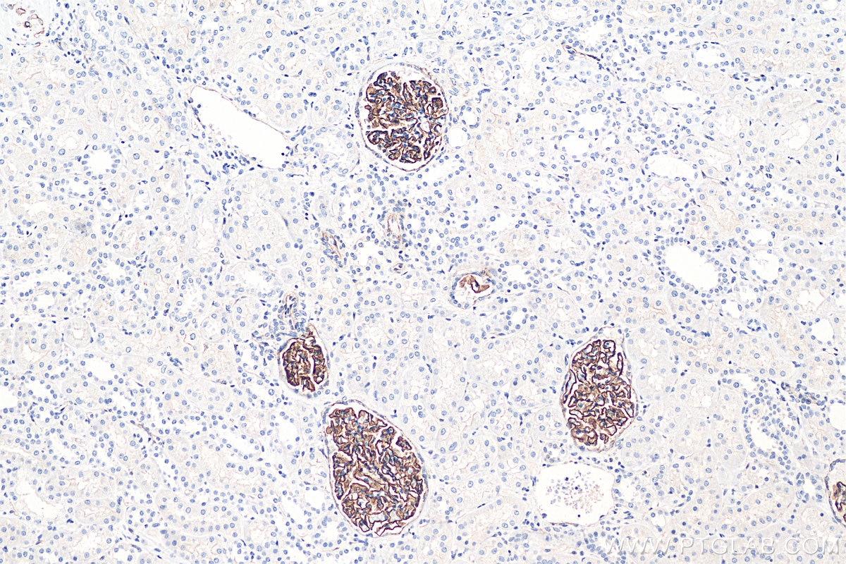 Immunohistochemistry (IHC) staining of human kidney tissue using SYNPO Recombinant antibody (80721-1-RR)