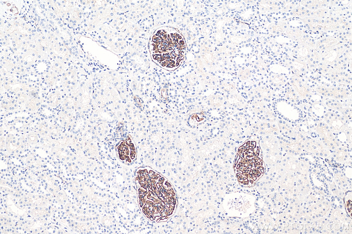 Immunohistochemistry (IHC) staining of human kidney tissue using SYNPO Recombinant antibody (80721-1-RR)