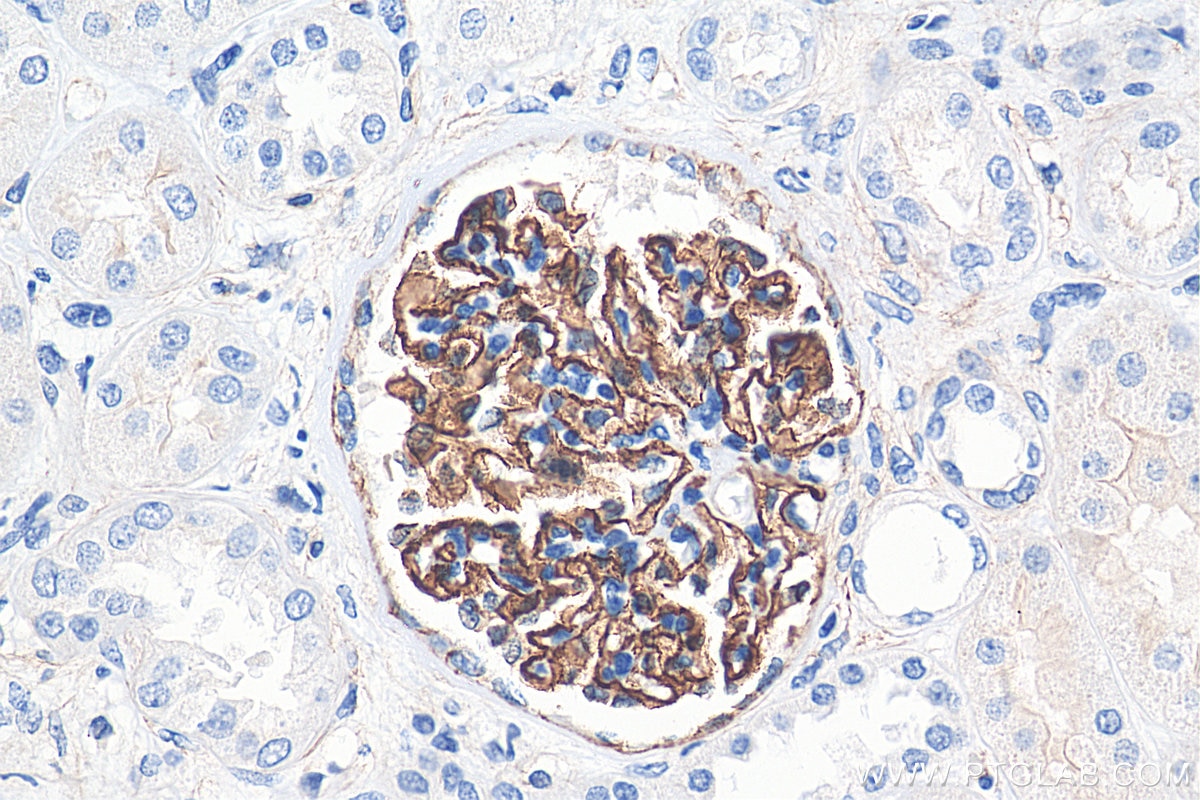 Immunohistochemistry (IHC) staining of human kidney tissue using SYNPO Recombinant antibody (80721-1-RR)