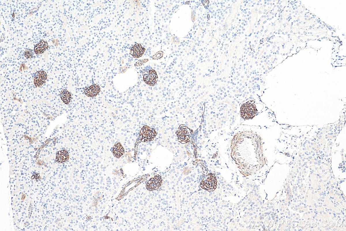 Immunohistochemistry (IHC) staining of mouse kidney tissue using SYNPO Recombinant antibody (80721-1-RR)