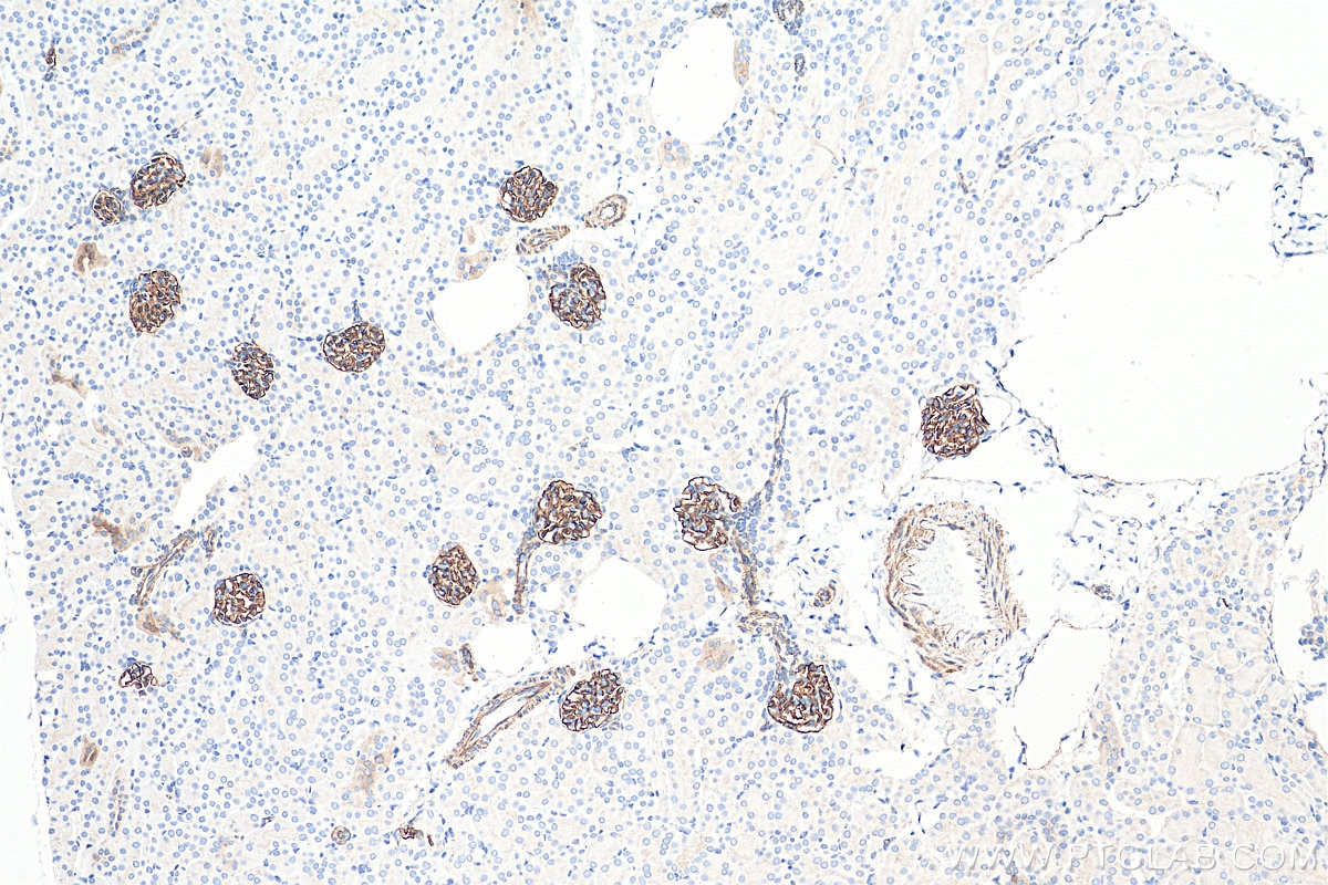 Immunohistochemistry (IHC) staining of mouse kidney tissue using SYNPO Recombinant antibody (80721-1-RR)