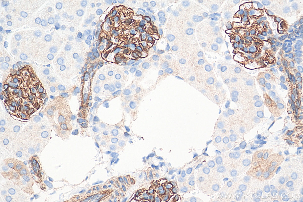 Immunohistochemistry (IHC) staining of mouse kidney tissue using SYNPO Recombinant antibody (80721-1-RR)