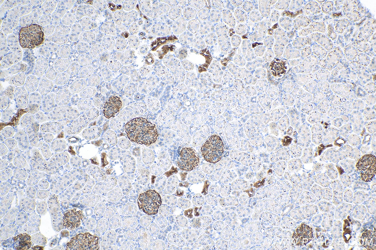 Immunohistochemistry (IHC) staining of rat kidney tissue using SYNPO Recombinant antibody (80721-1-RR)