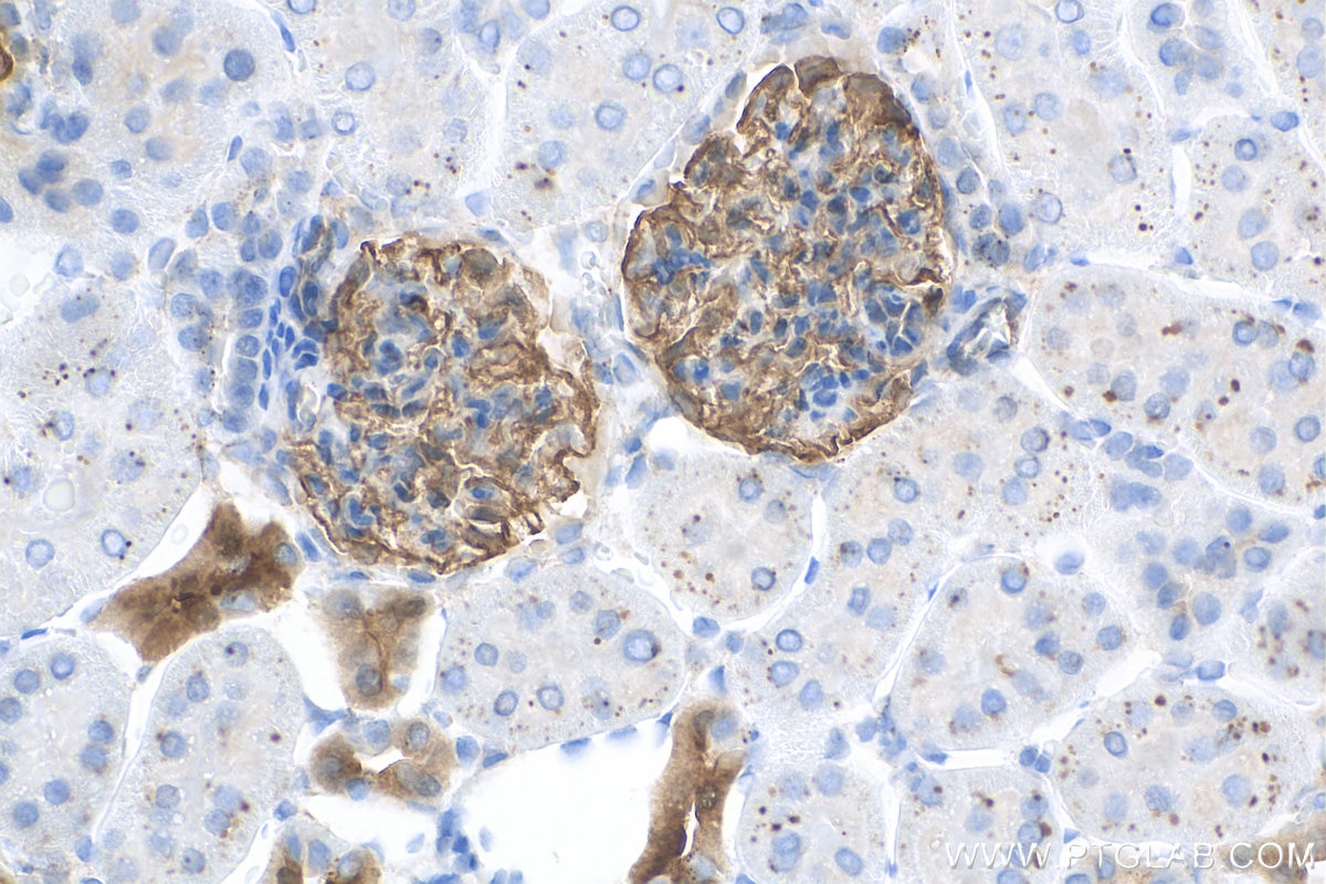 Immunohistochemistry (IHC) staining of rat kidney tissue using SYNPO Recombinant antibody (80721-1-RR)