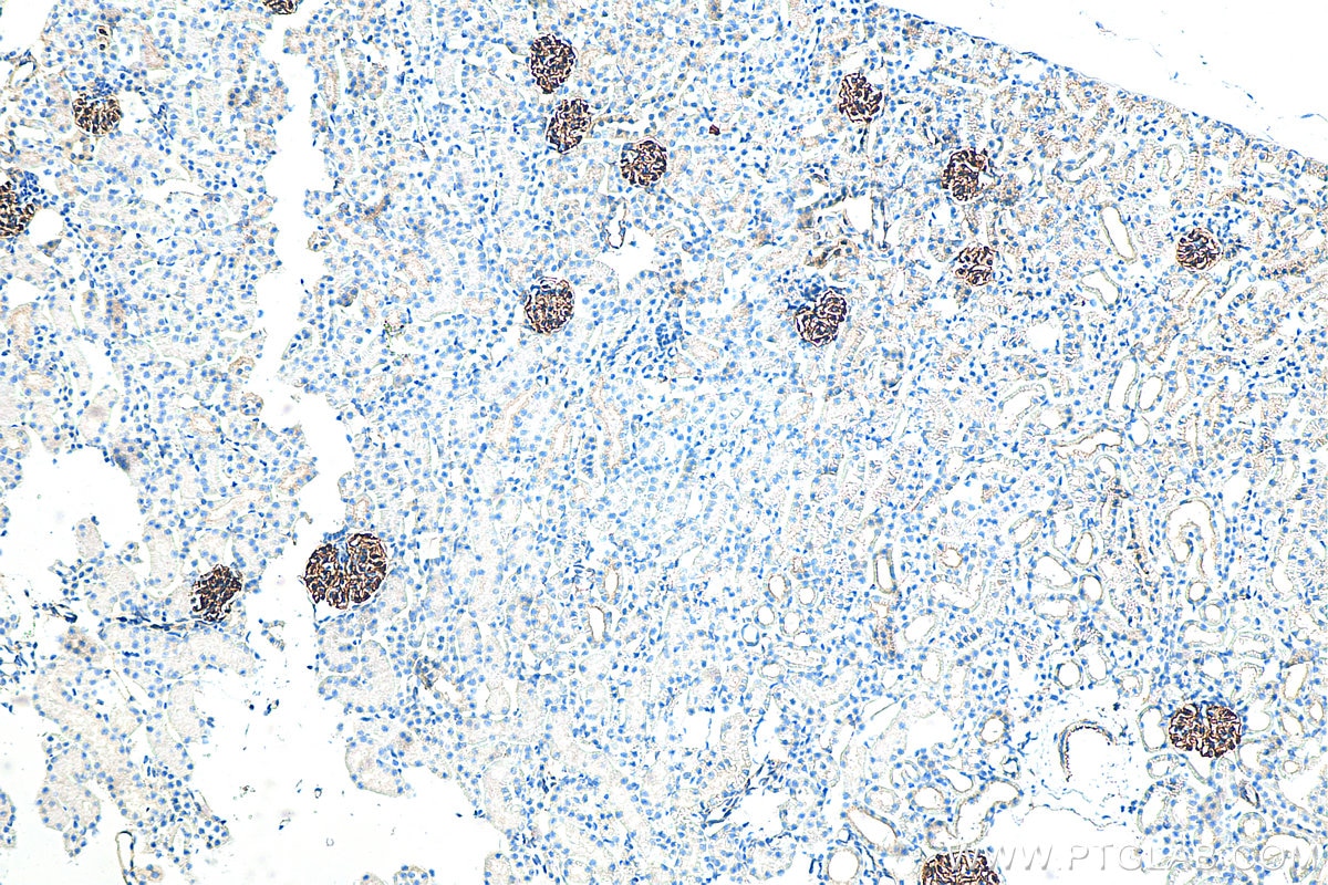 Immunohistochemistry (IHC) staining of mouse kidney tissue using SYNPO Recombinant antibody (80721-1-RR)