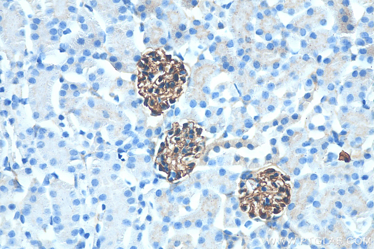 Immunohistochemistry (IHC) staining of mouse kidney tissue using SYNPO Recombinant antibody (80721-1-RR)