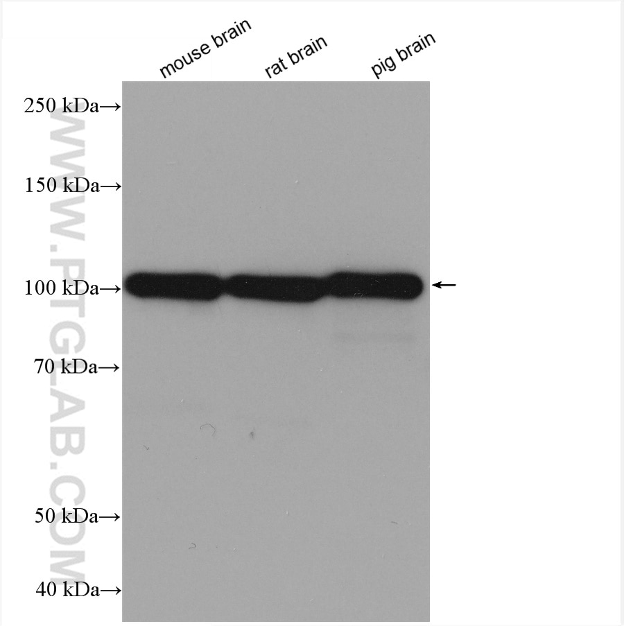 Western Blot (WB) analysis of various lysates using SYNPO Recombinant antibody (80721-1-RR)