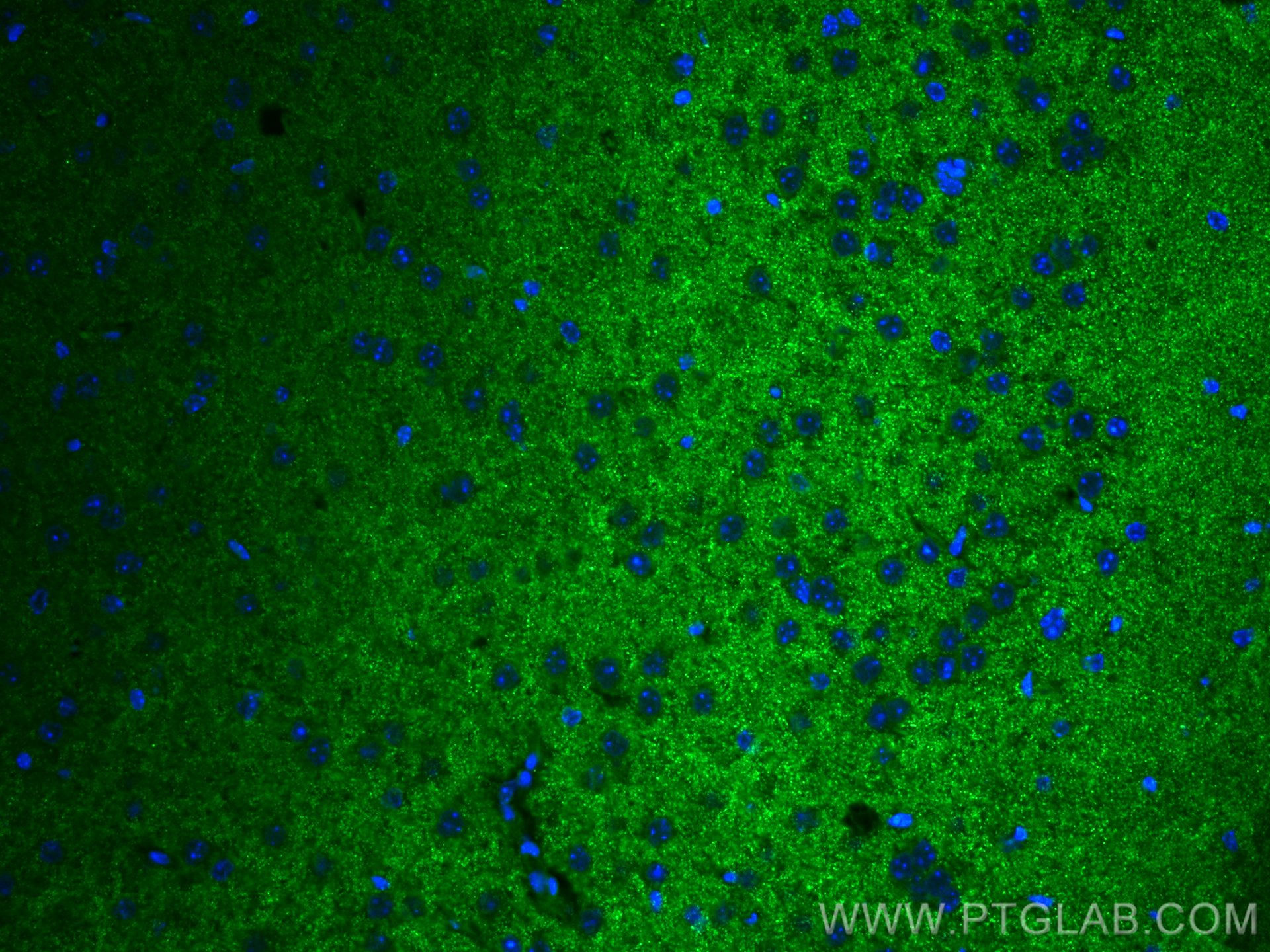 Immunofluorescence (IF) / fluorescent staining of mouse brain tissue using CoraLite® Plus 488-conjugated SYNPO Monoclonal ant (CL488-67339)