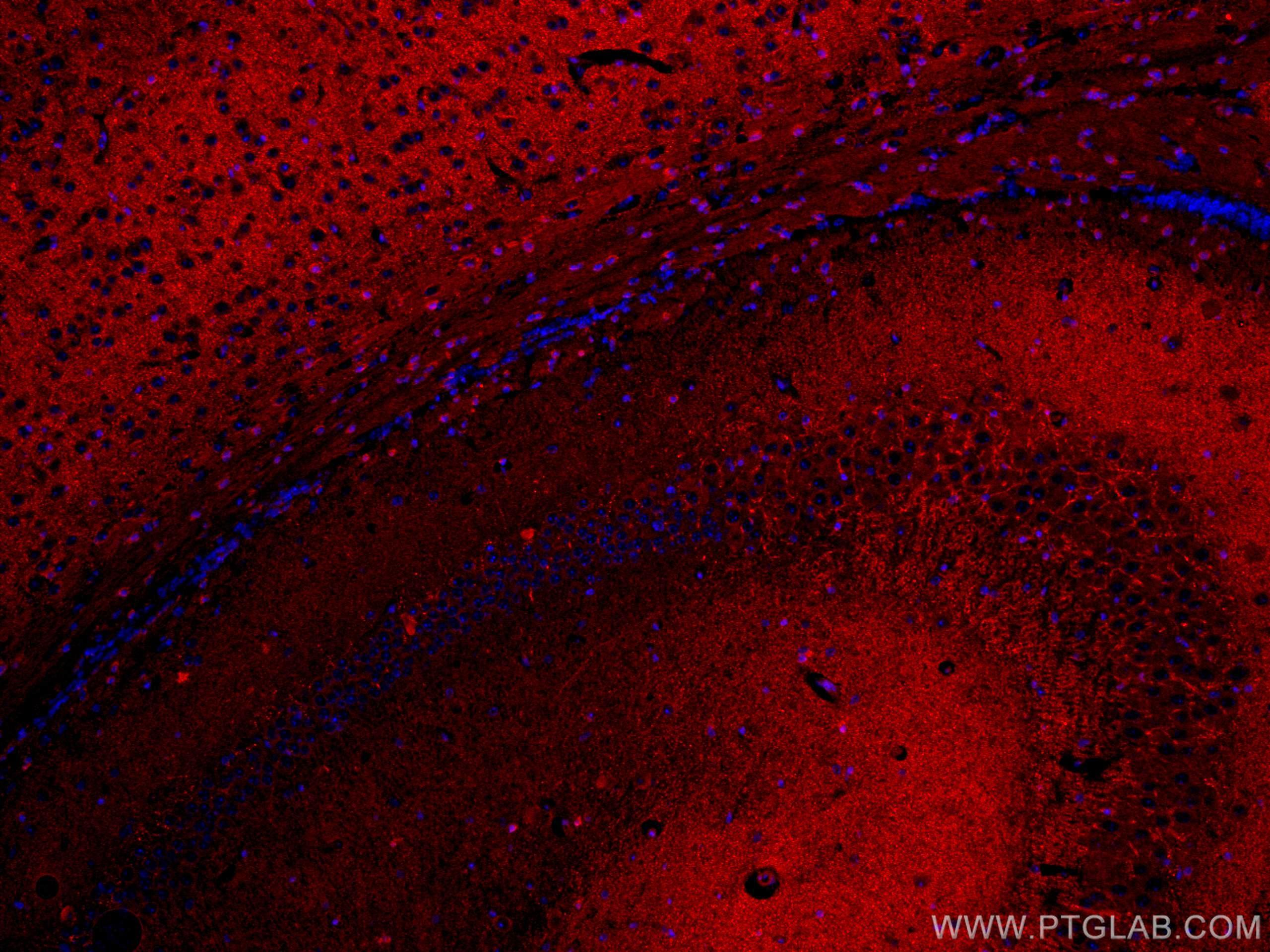 Immunofluorescence (IF) / fluorescent staining of mouse brain tissue using CoraLite®594-conjugated SYNPO Monoclonal antibody (CL594-67339)