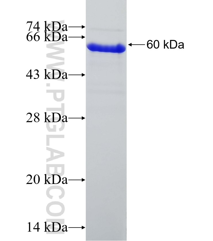 SYNPO2 fusion protein Ag22176 SDS-PAGE
