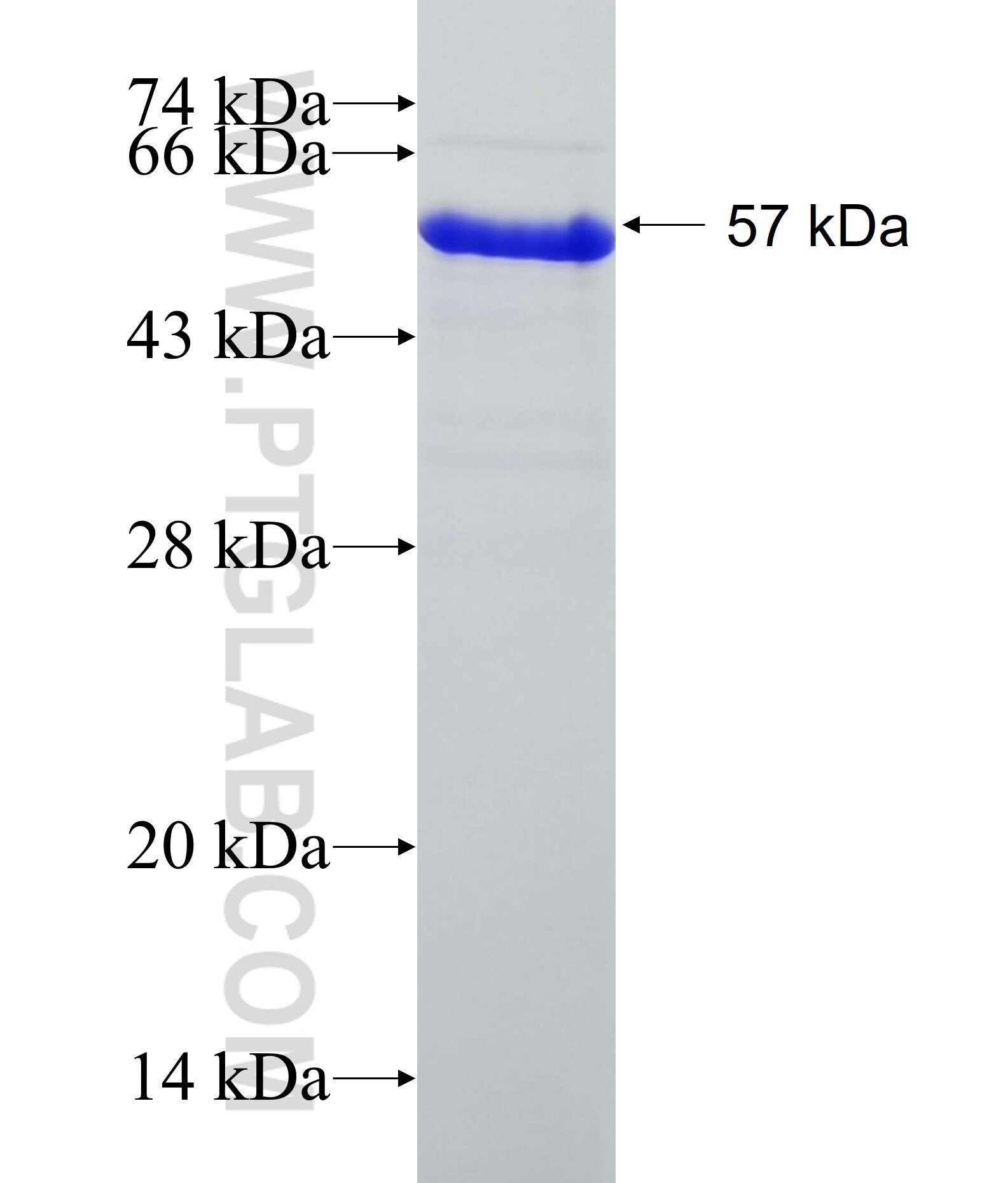 SYNPO2 fusion protein Ag22176 SDS-PAGE