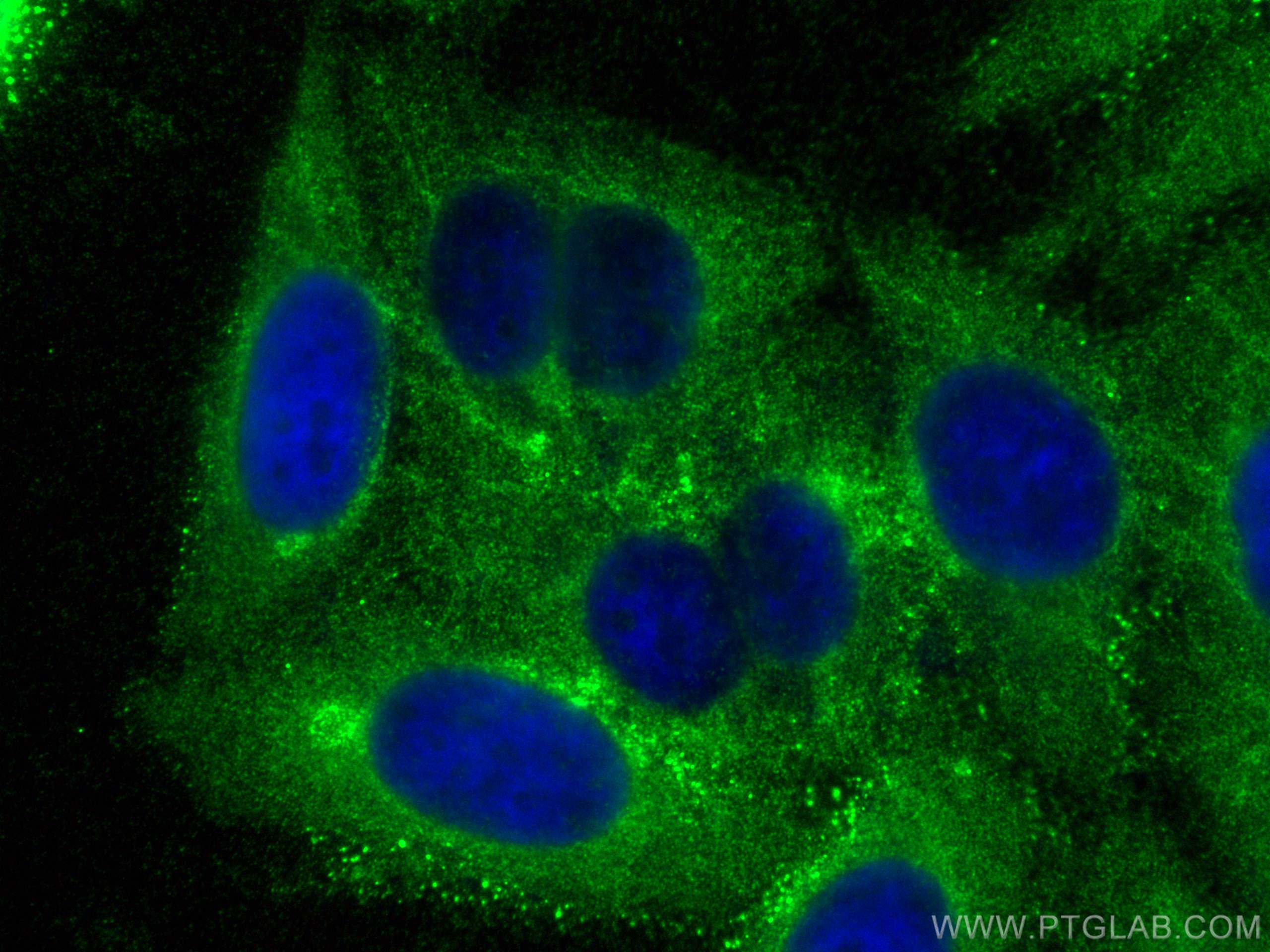 Immunofluorescence (IF) / fluorescent staining of HepG2 cells using SYNPO2L Polyclonal antibody (21480-1-AP)