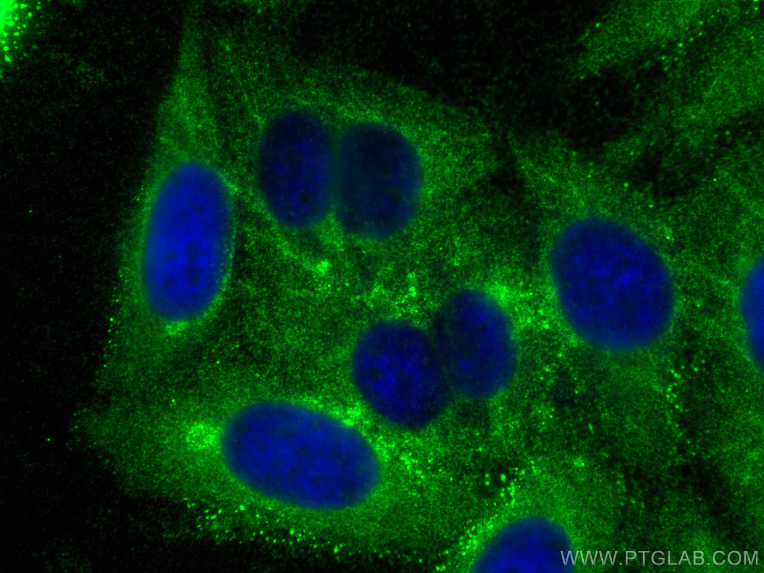 IF Staining of HepG2 using 21480-1-AP