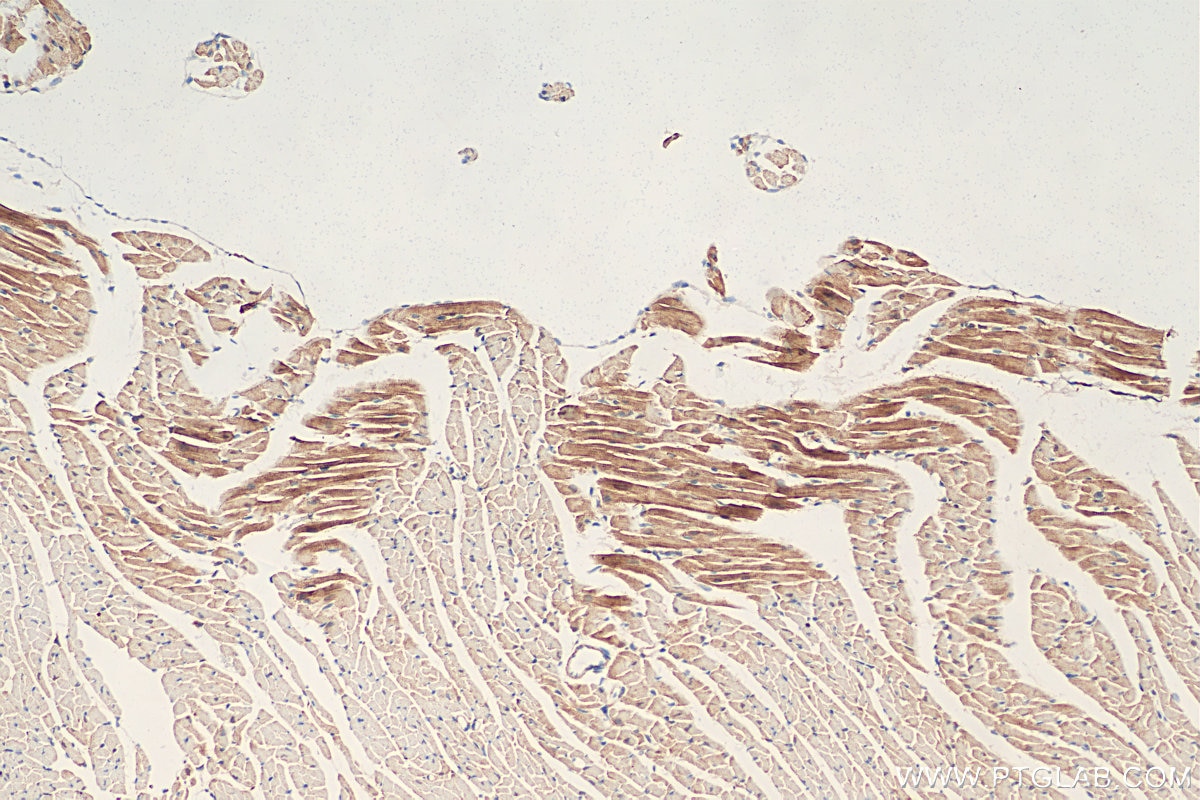 Immunohistochemistry (IHC) staining of mouse heart tissue using SYNPO2L Polyclonal antibody (21480-1-AP)