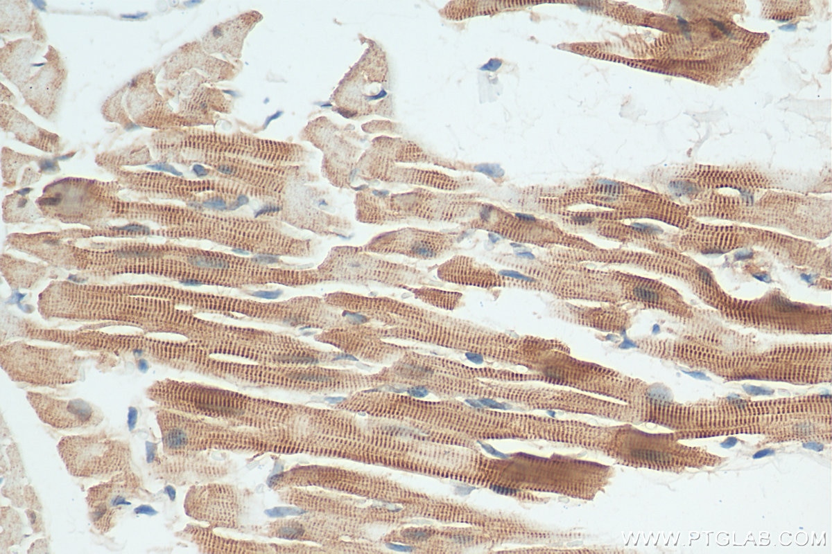 Immunohistochemistry (IHC) staining of mouse heart tissue using SYNPO2L Polyclonal antibody (21480-1-AP)